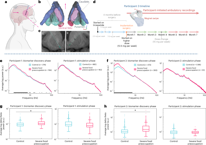 Brain recordings suggest tirzepatide's effect on food noise may fade after about five months